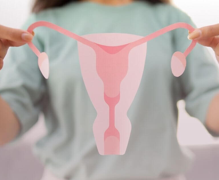 PCOS – co to jest? 3 co to jest pcos