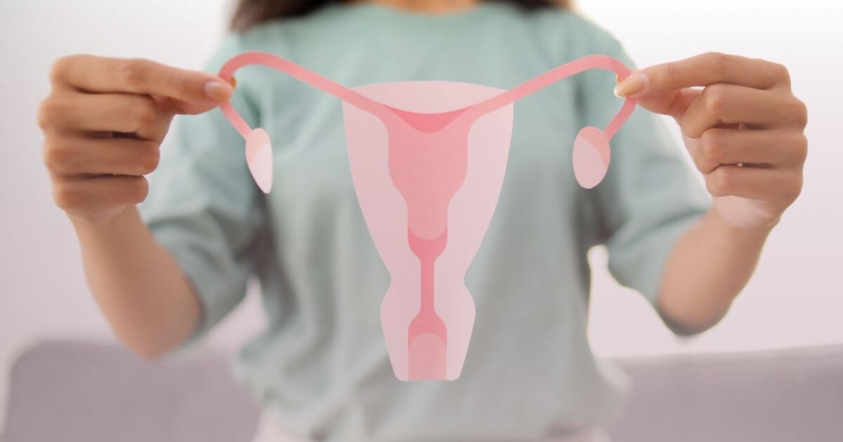 PCOS – co to jest? 1 co to jest pcos